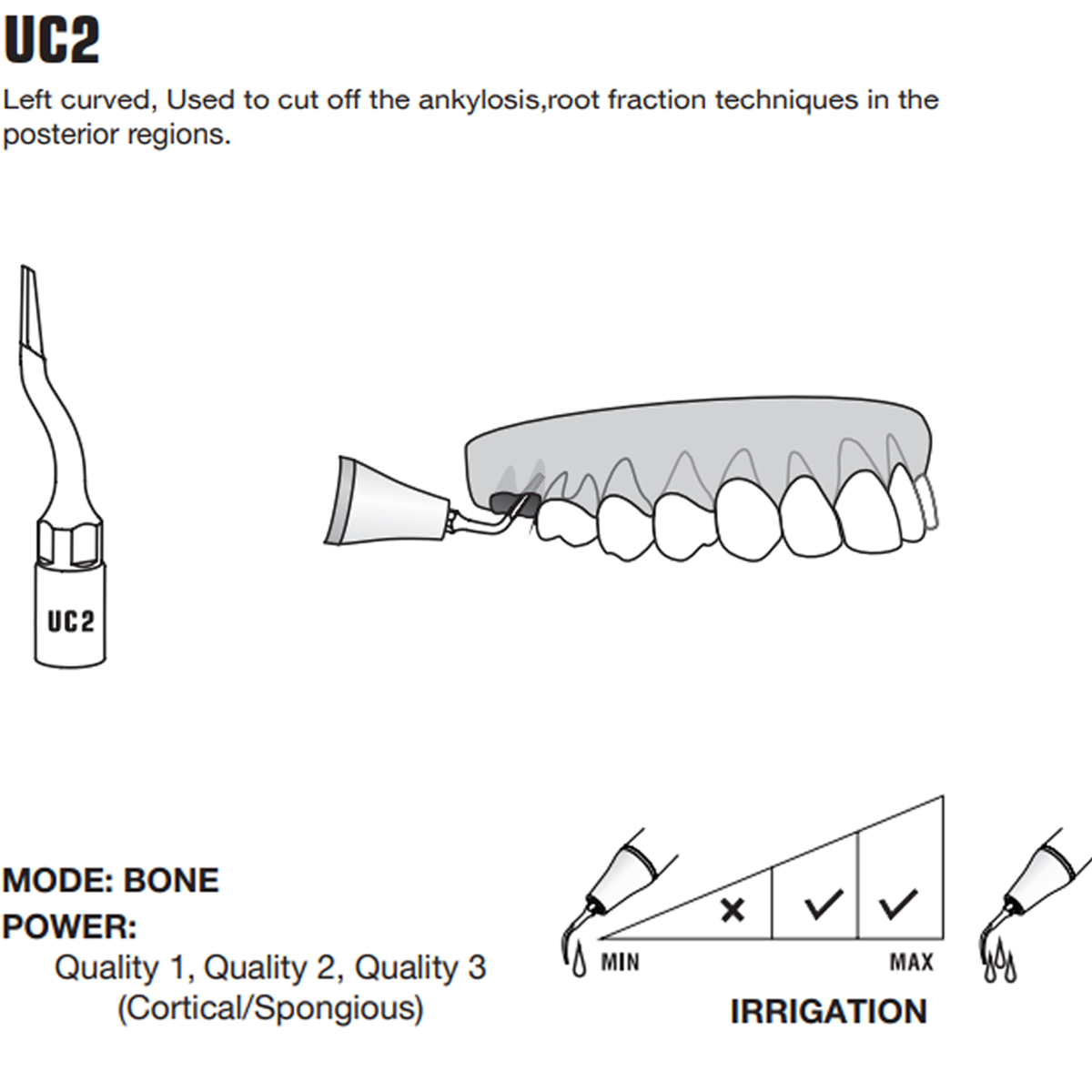 Woodpecker Piezo Bone Surgery Tips
