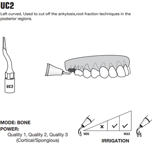 Woodpecker Piezo Bone Surgery Tips