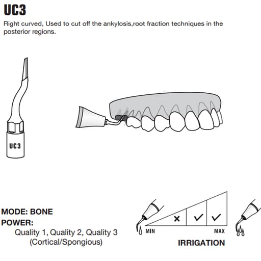 Woodpecker Piezo Bone Surgery Tips