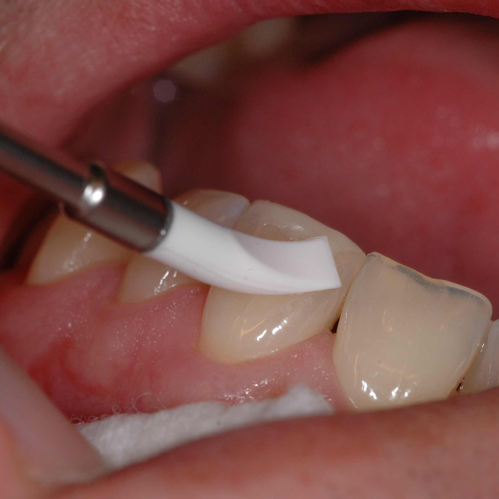 Younique Composite Silicone Brushes Set Of 5