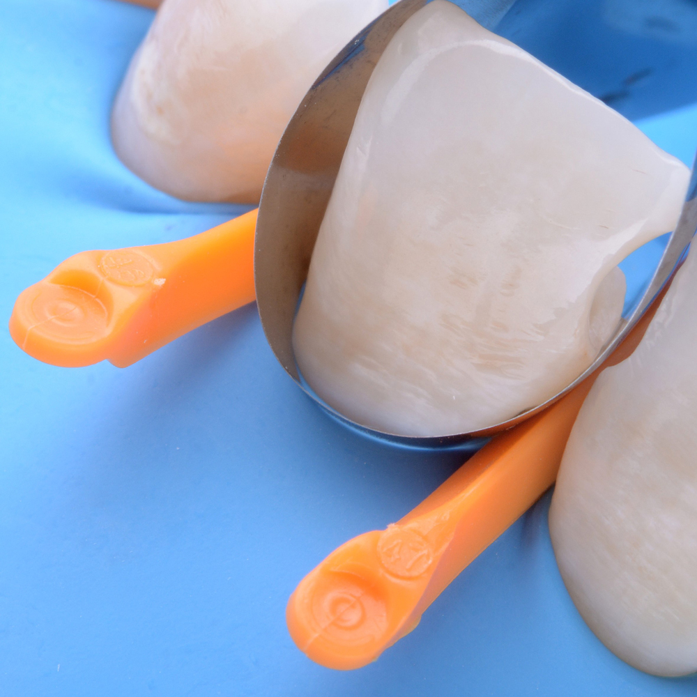 Polydentia MyWedge Interproximal Wedges Assorted - 7100 (Pack of 100)