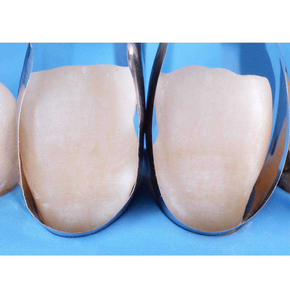 Polydentia Unica Anterior Matrix System Kit & Refills