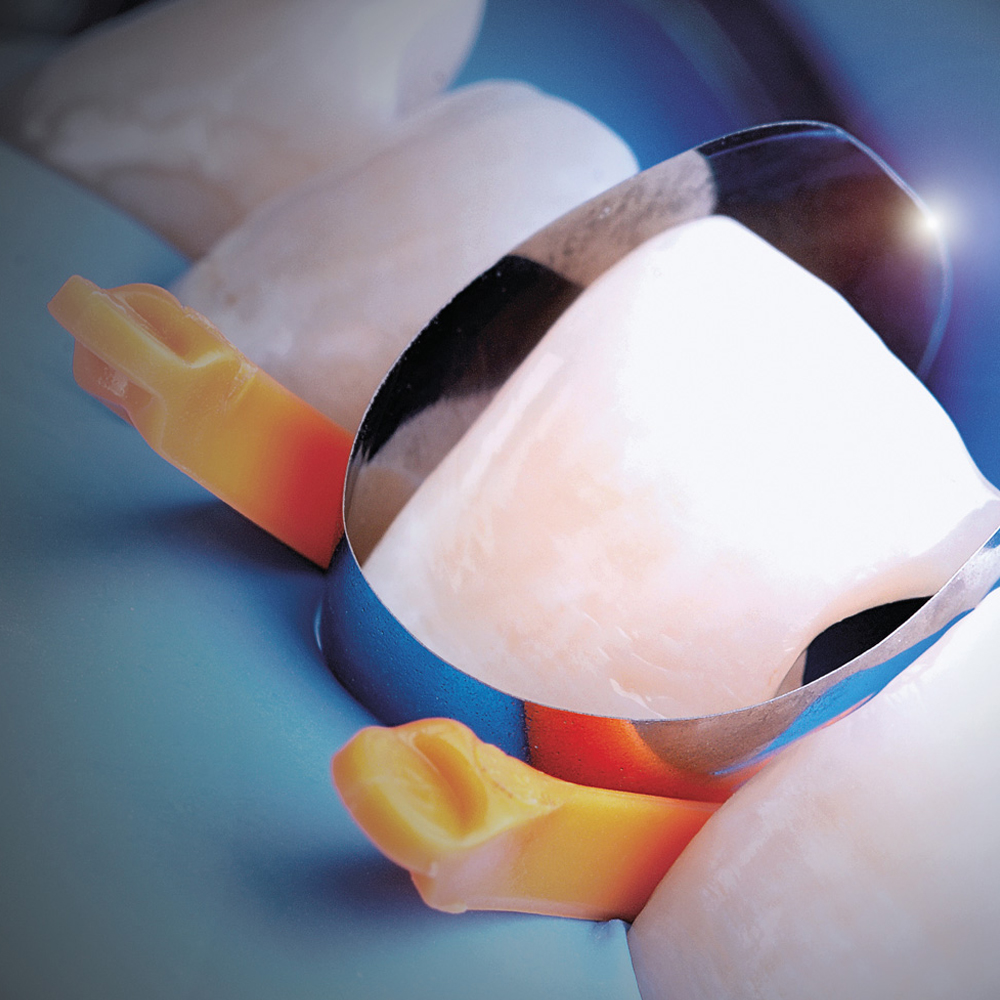 Polydentia Unica Anterior Matrix System Kit & Refills