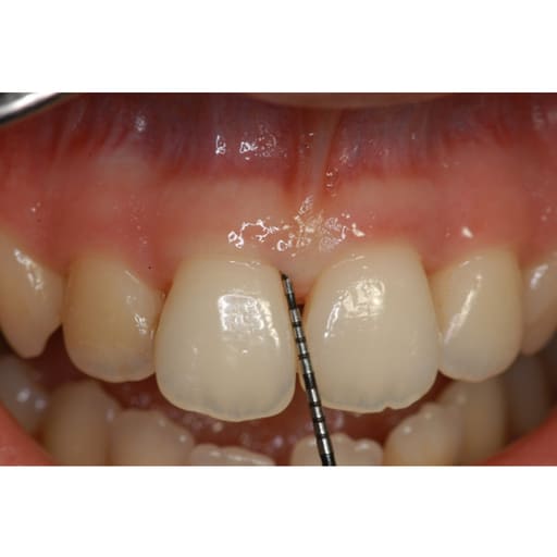 GDC University of North Carolina/William Premium - 6 (PCPUNC15/W6)