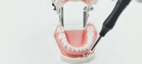 Julldent Crown Remover ( Christensen Design )