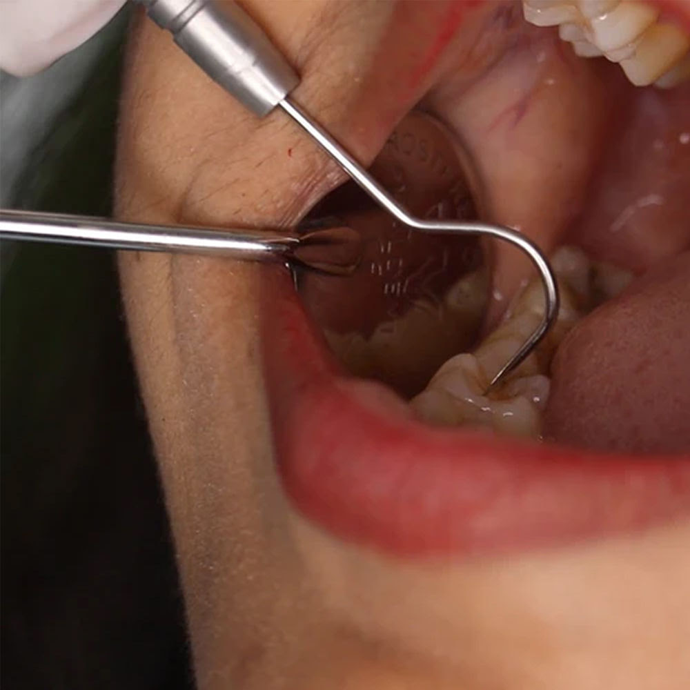 Oracraft Pmt Set Of 3 Instruments Kit - PMTS4