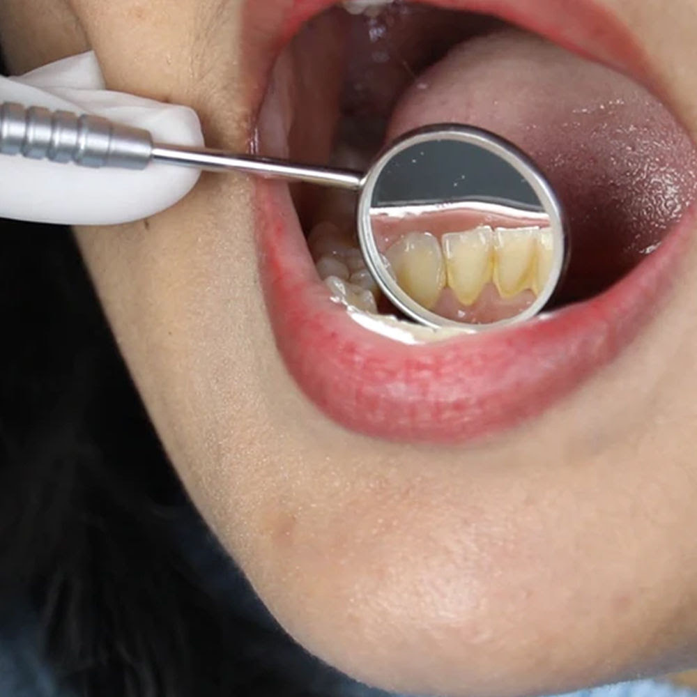 Oracraft Pmt Set Of 3 Instruments Kit - PMTS4