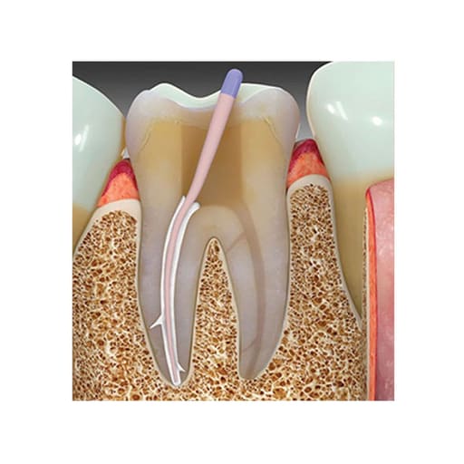Prime Dental Prime MTA Bioceramic Root Canal Sealer