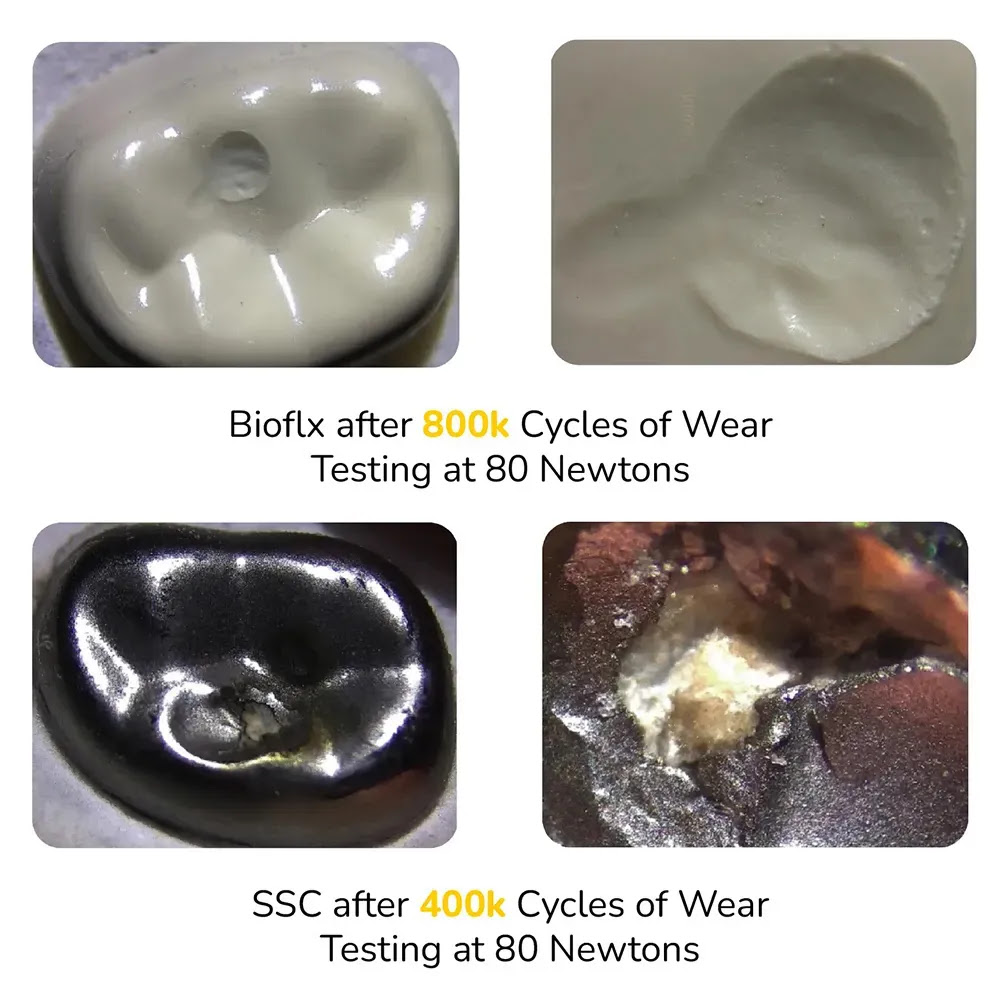 Kids-e-Dental Bioflx Anterior Crown Kits