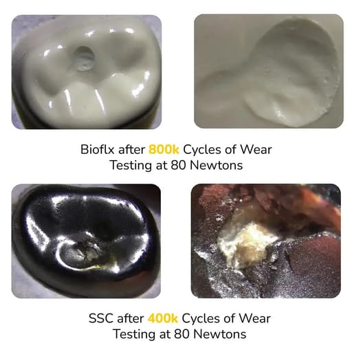 Kids-e-Dental Bioflx Anterior Crown Kits