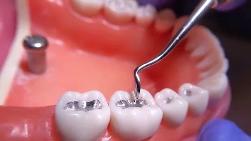 GI Dental Diamond Carver