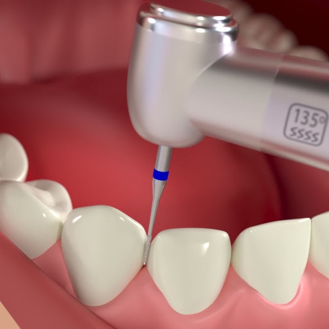 Prima Dental Needle Bur FG (Pack Of 5 Burs) 859 (010)