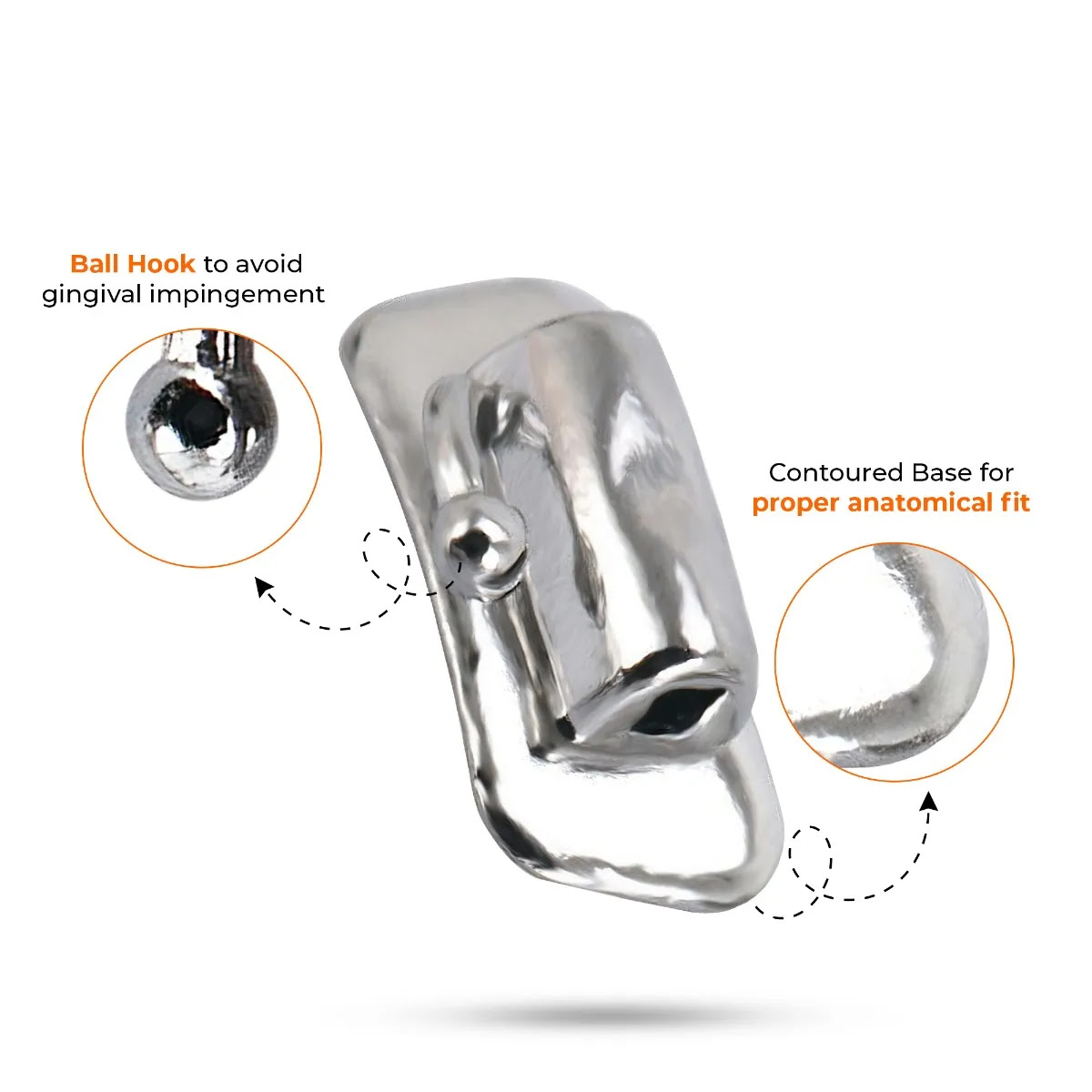 U Ortho Bondable Buccal Tubes - 1st Molar MBT 0.022 - U1/L1