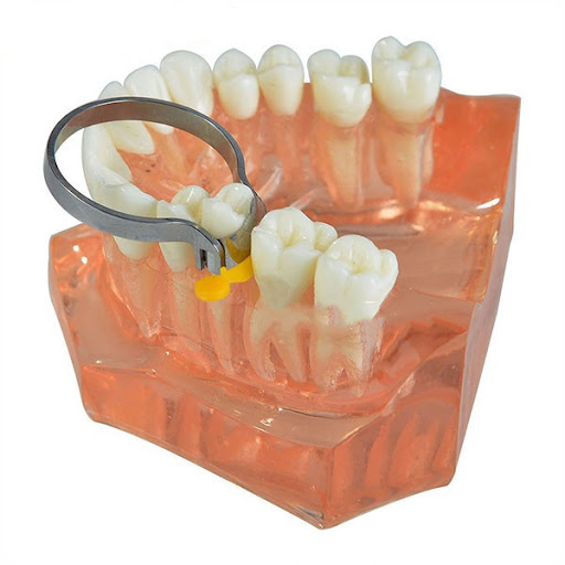 ET Dental Sectional Contoured Matrices Kit