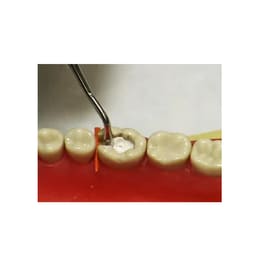 Waldent Conservative Instrument Kit of 20 (K15/1) - 19