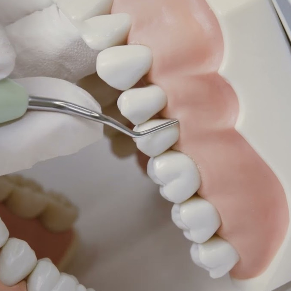 GDC Langer Curettes 3/4 For Maxillary Posterior #6 (Sl3/4)