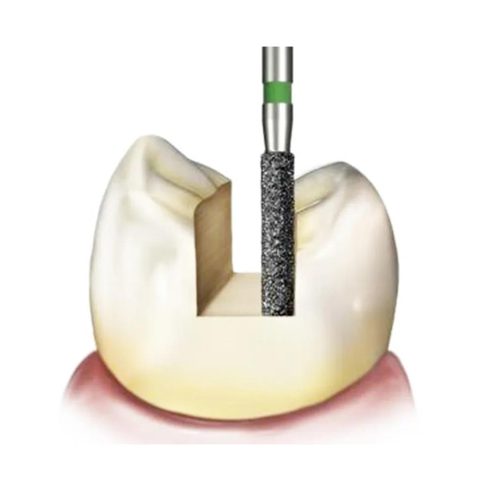 Frank Dental Cylinder Flat End Diamond Bur SF Series (Coarse)