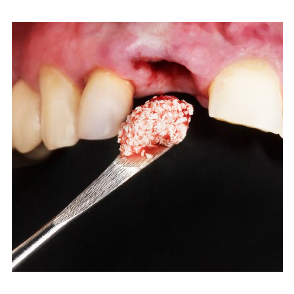 Waldent Conservative Instrument Kit of 20 (K15/1)