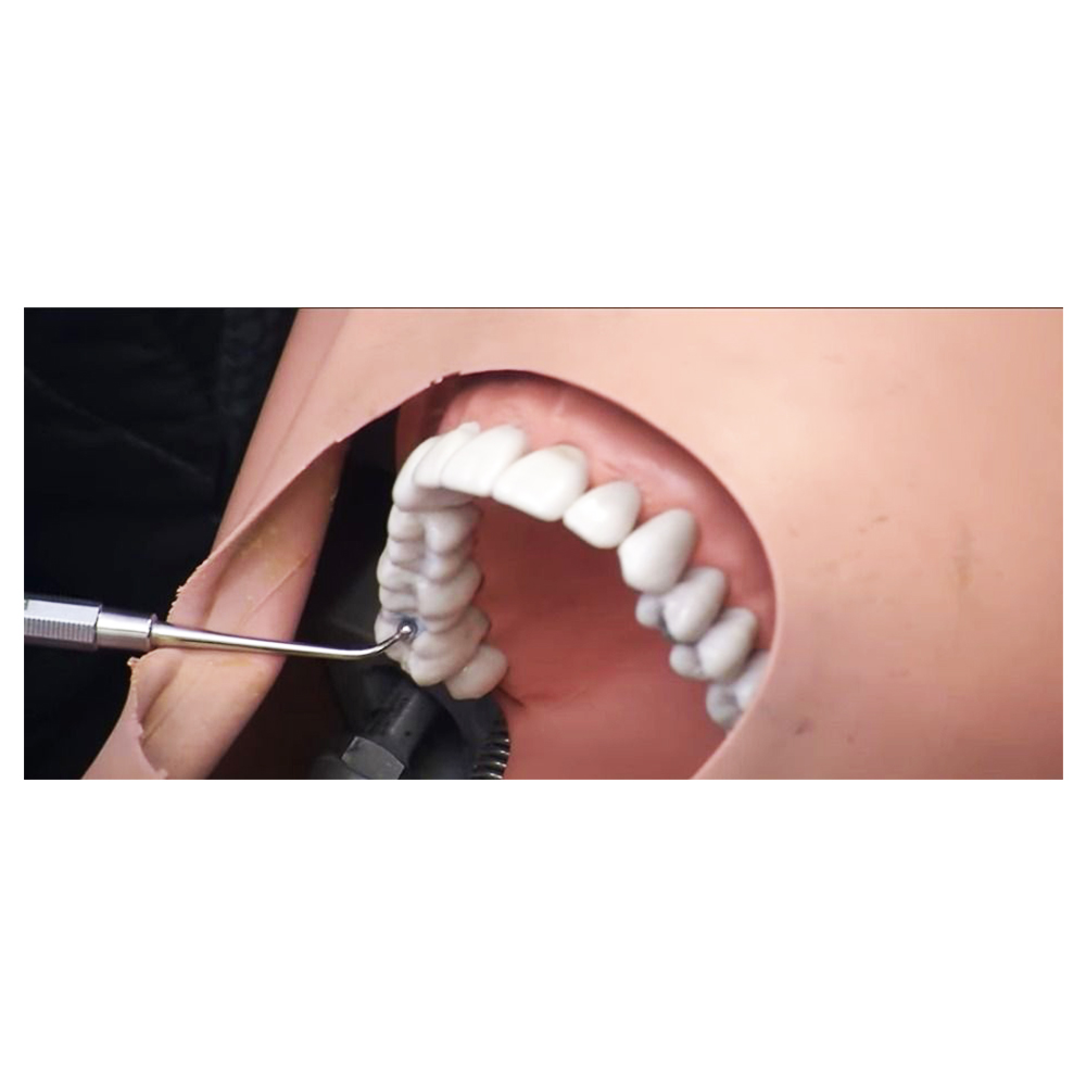 Waldent Conservative Instrument Kit of 20 (K15/1)