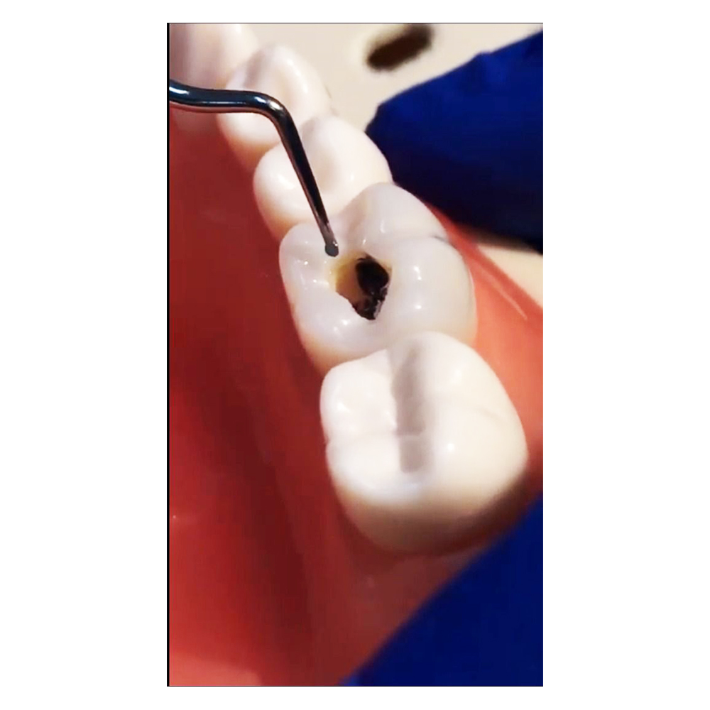 Waldent Conservative Instrument Kit of 20 (K15/1)