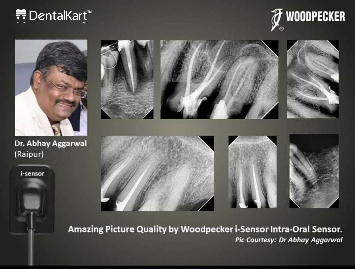 Woodpecker RVG i Sensor Size - 1 (Compatible With Windows only)