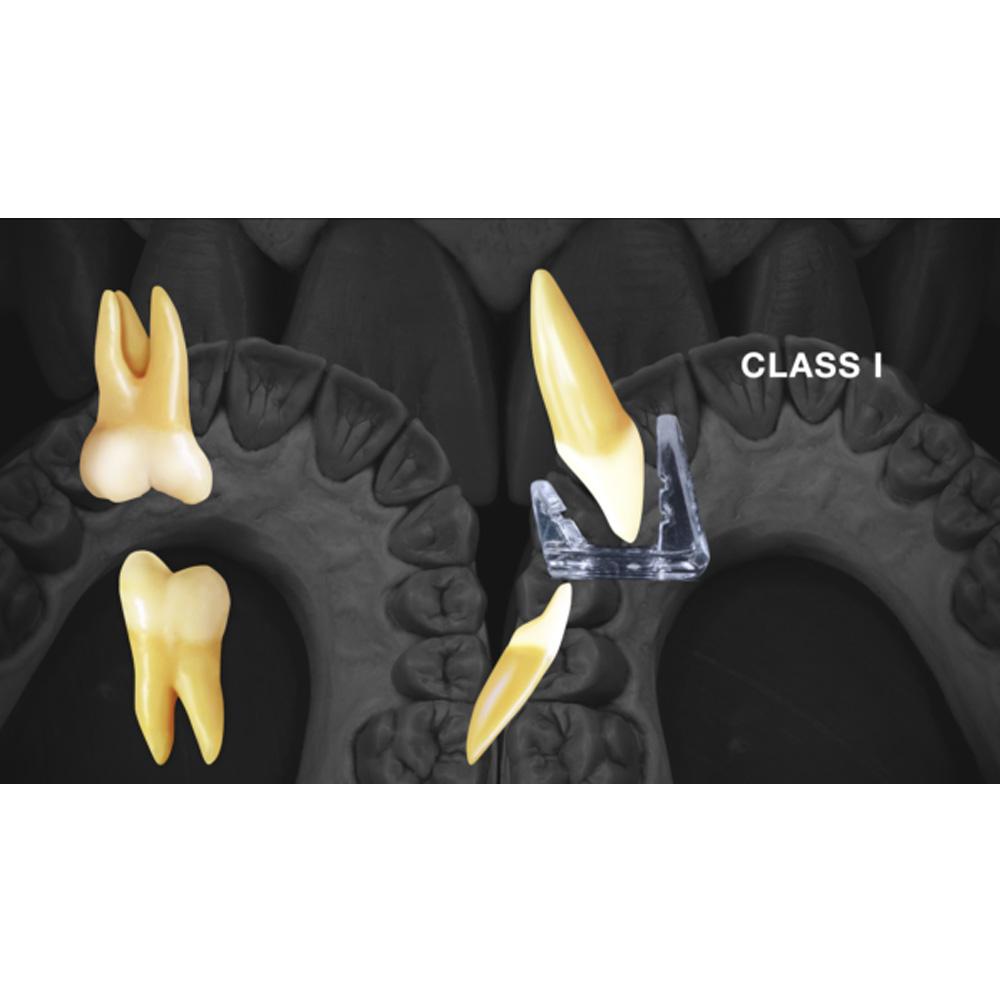 MiK Unwind MD Muscle Deprogrammer - Standard