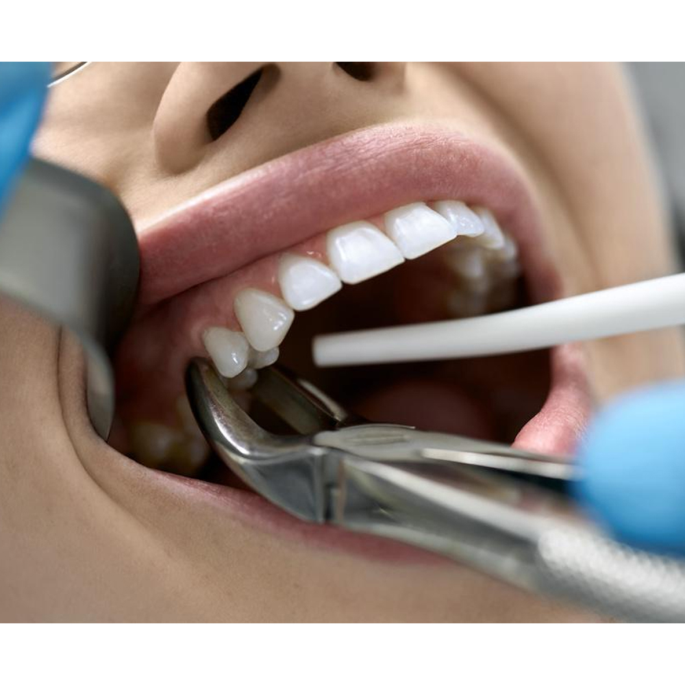 GDC Extraction Forceps Upper Premolar - 7 Standard (FX7S)