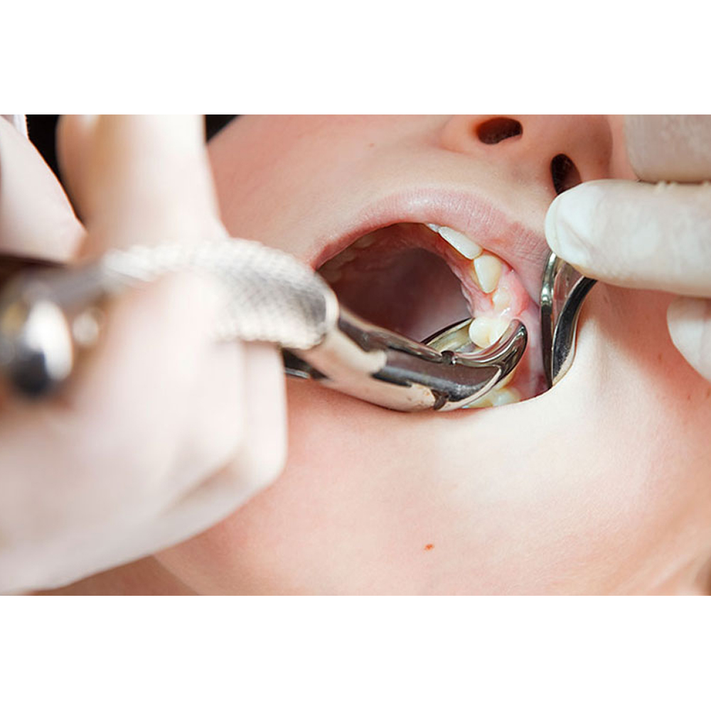 GDC Extraction Forceps Upper Roots - 44 Standard (FX44S)