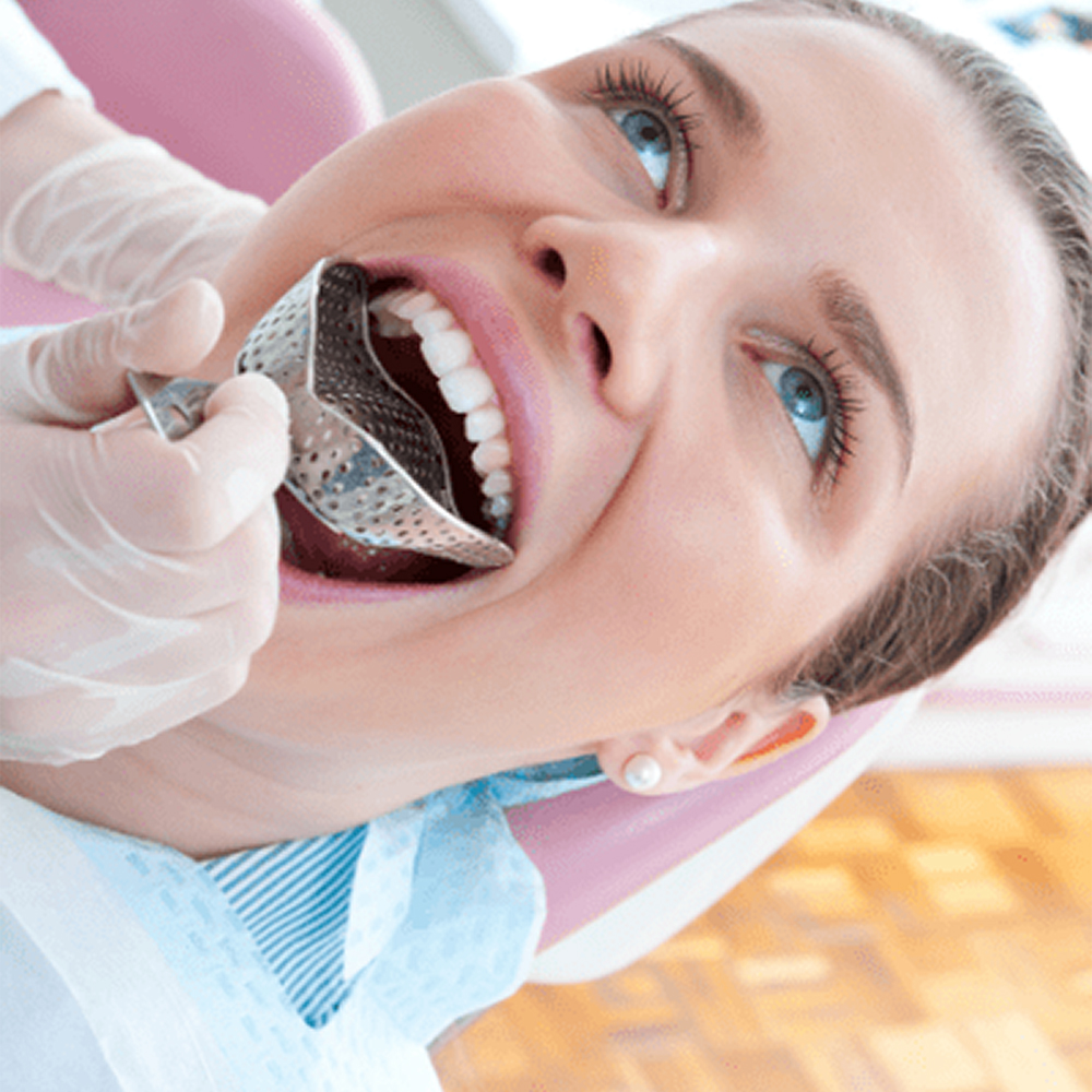 GDC Dentulous Perforated Impression Trays Upper # 1 (ITRLDPU1)