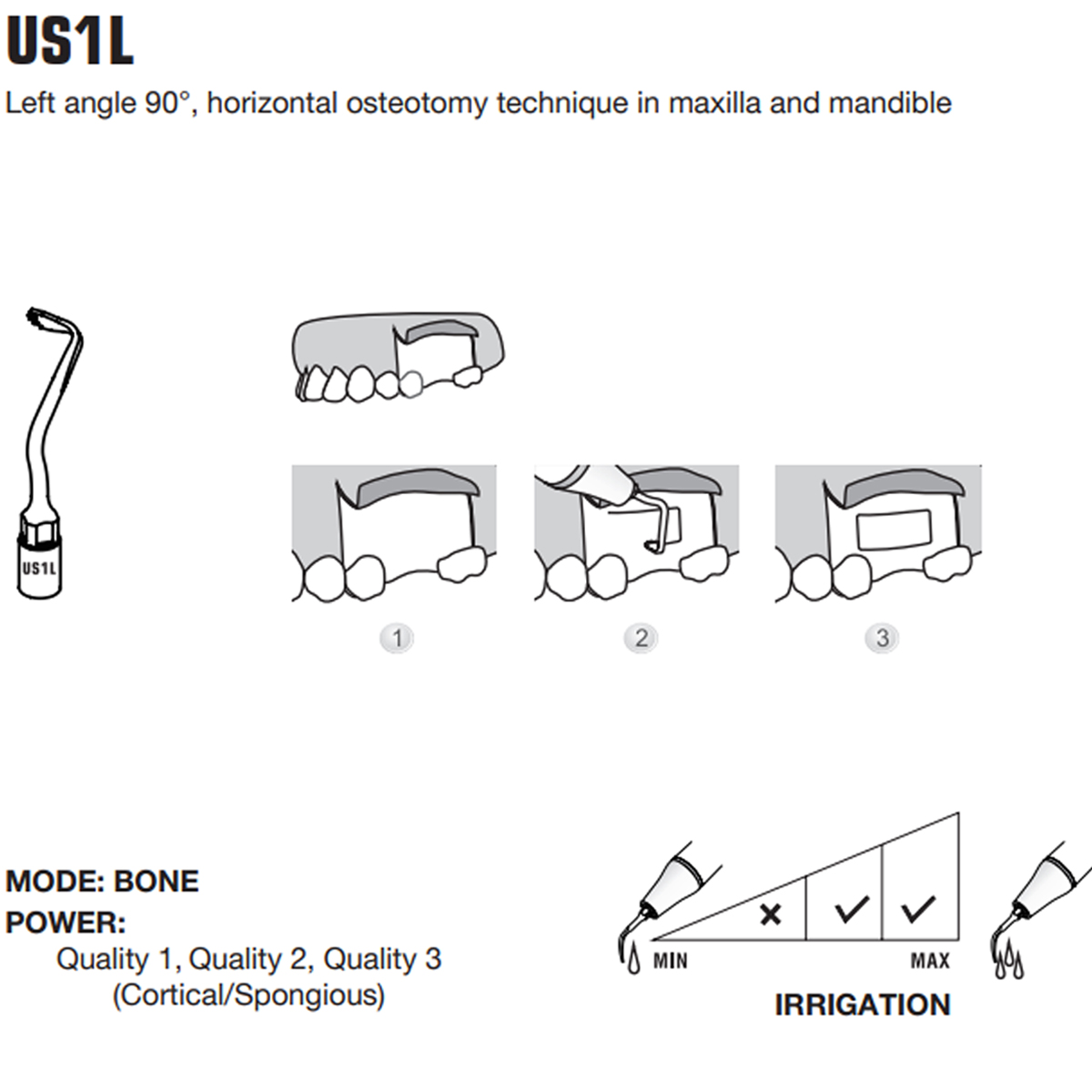 Woodpecker Piezo Bone Surgery Tips