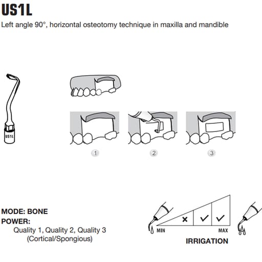 Woodpecker Piezo Bone Surgery Tips