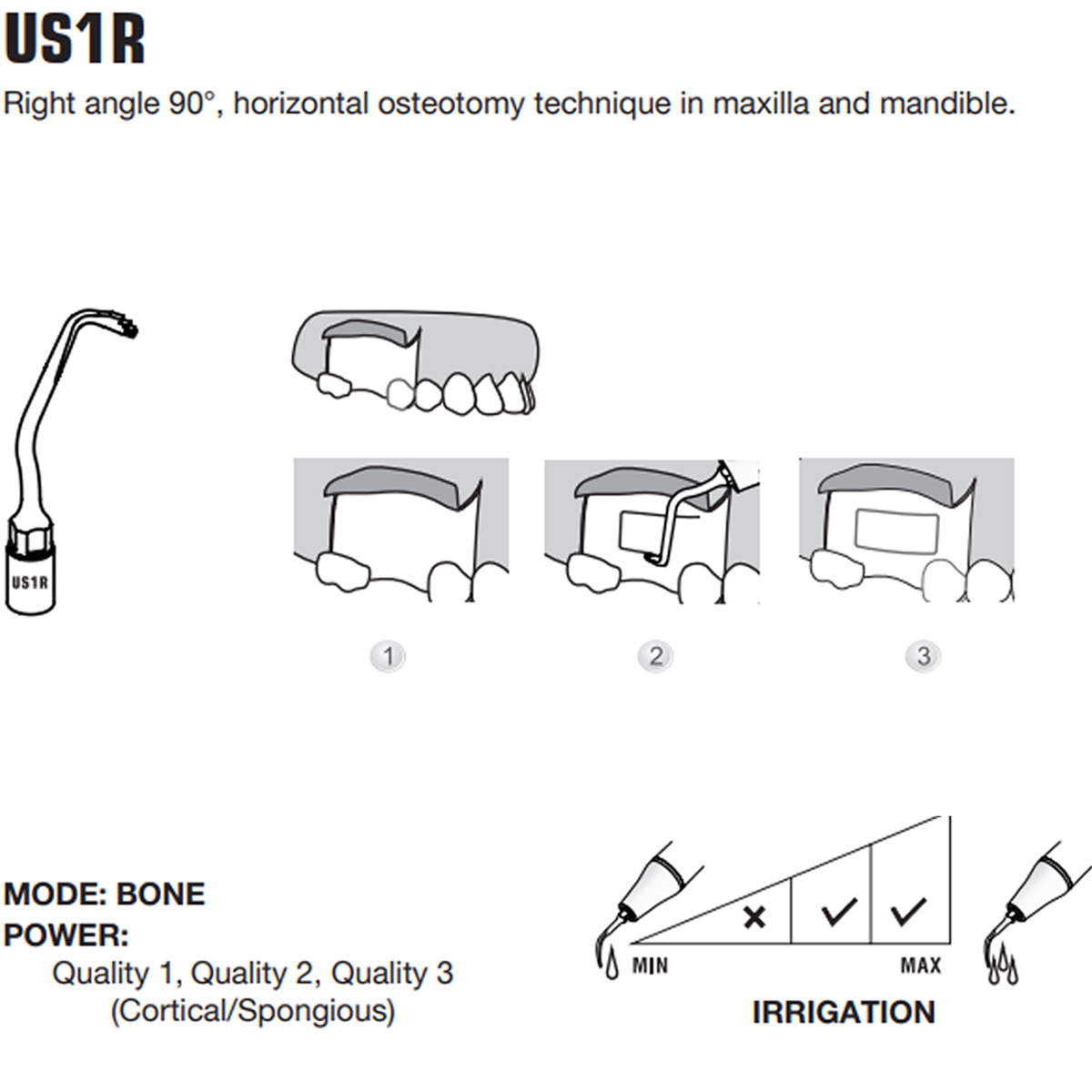 Woodpecker Piezo Bone Surgery Tips