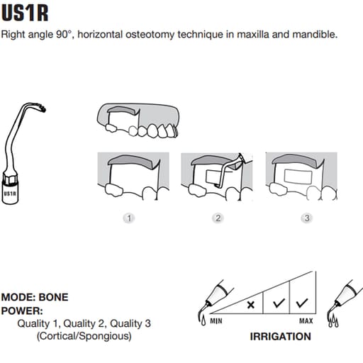 Woodpecker Piezo Bone Surgery Tips