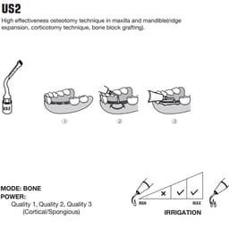 Woodpecker Piezo Bone Surgery Tips - 6