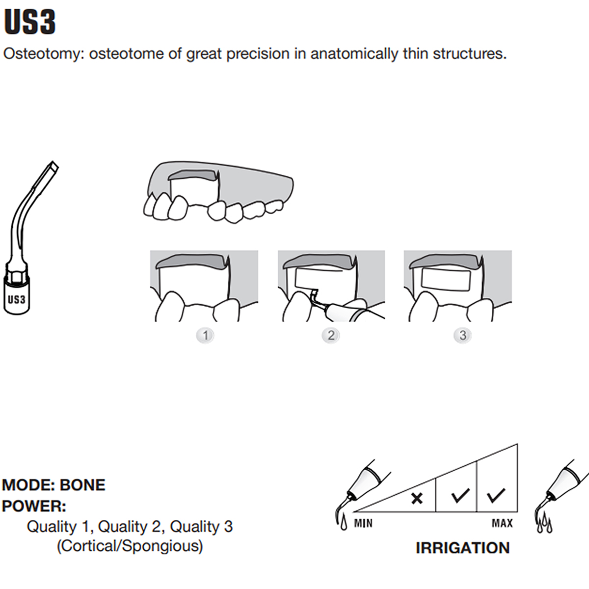 Woodpecker Piezo Bone Surgery Tips