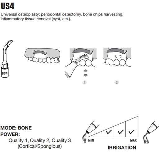 Woodpecker Piezo Bone Surgery Tips