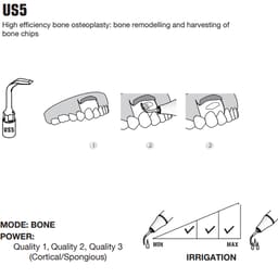 Woodpecker Piezo Bone Surgery Tips - 9