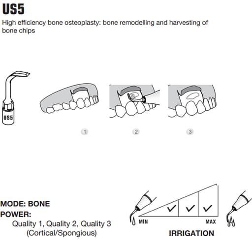 Woodpecker Piezo Bone Surgery Tips
