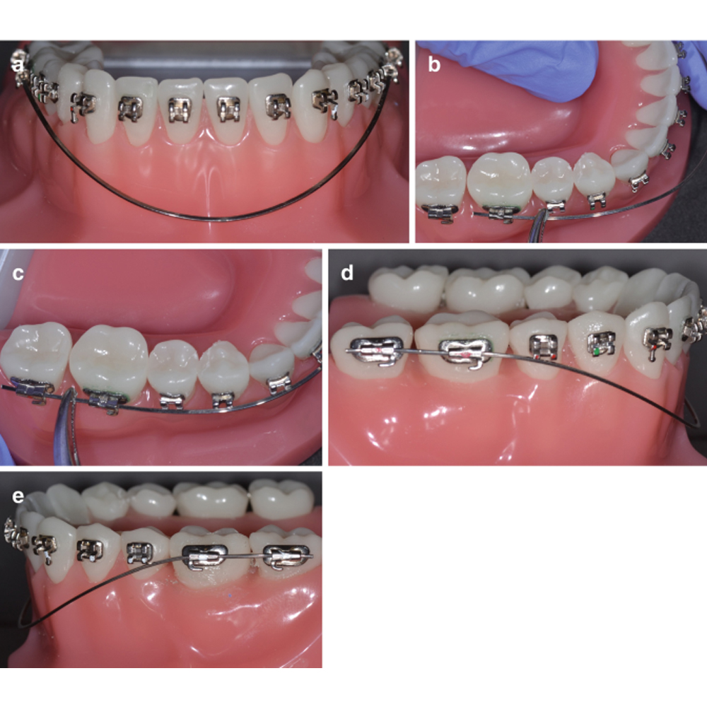 Koden Reverse Curve NiTi Archwires - Rectangular (Pack of 2)