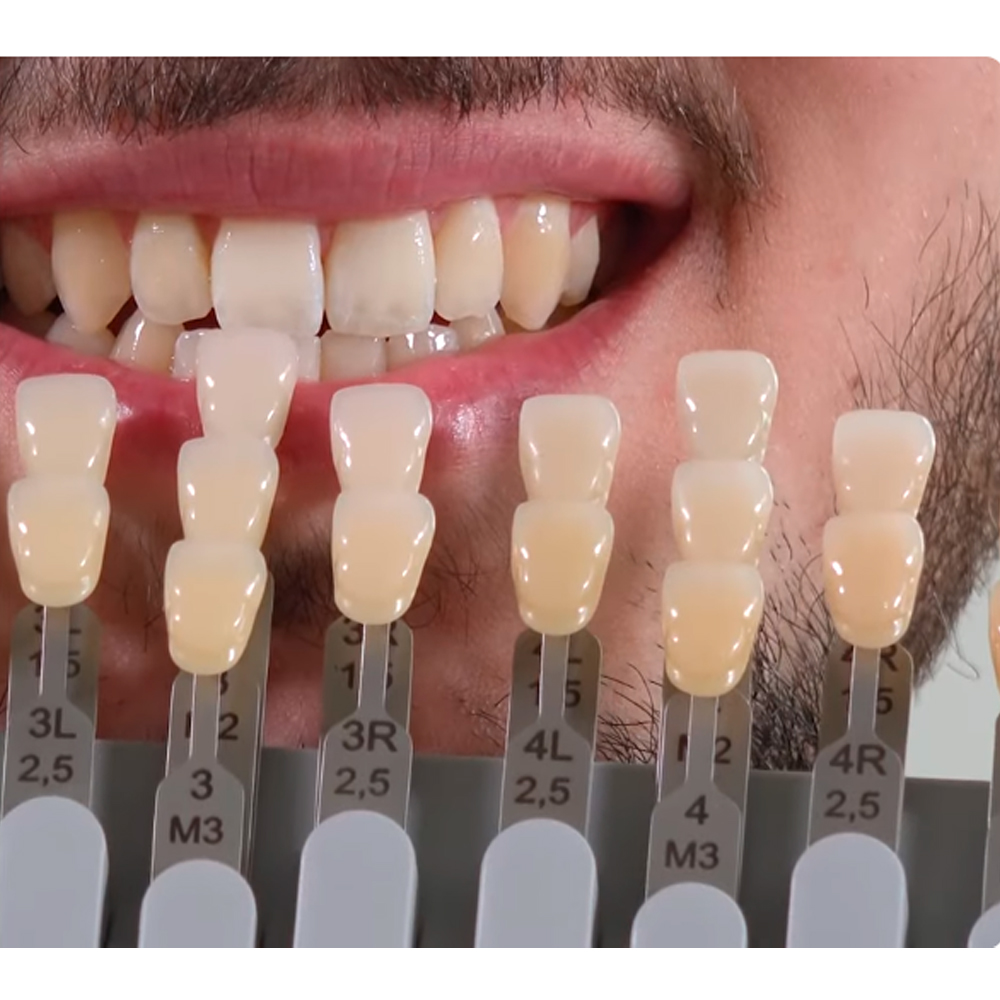 Vita Toothguide 3d-Master With Bleached Shades