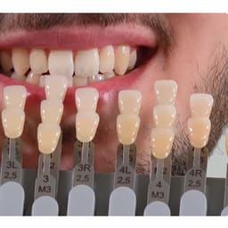 Vita Toothguide 3d-Master With Bleached Shades - 7