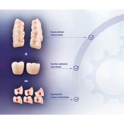 Vita MFT Denture Teeth 2M1 (Set of 28) - 11