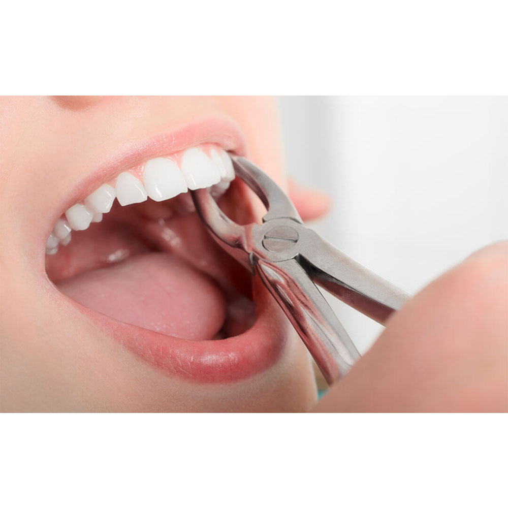 Waldent Atraumatic Extraction Instruments Forceps Kit Set of 6 - Coarse Serrations K1/5