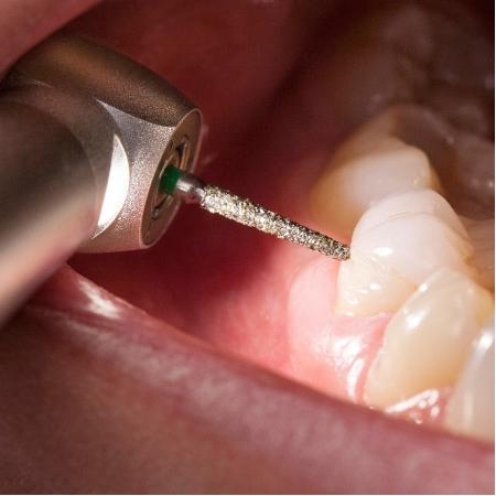 Waldent LED Airotor Handpiece And Cartridge