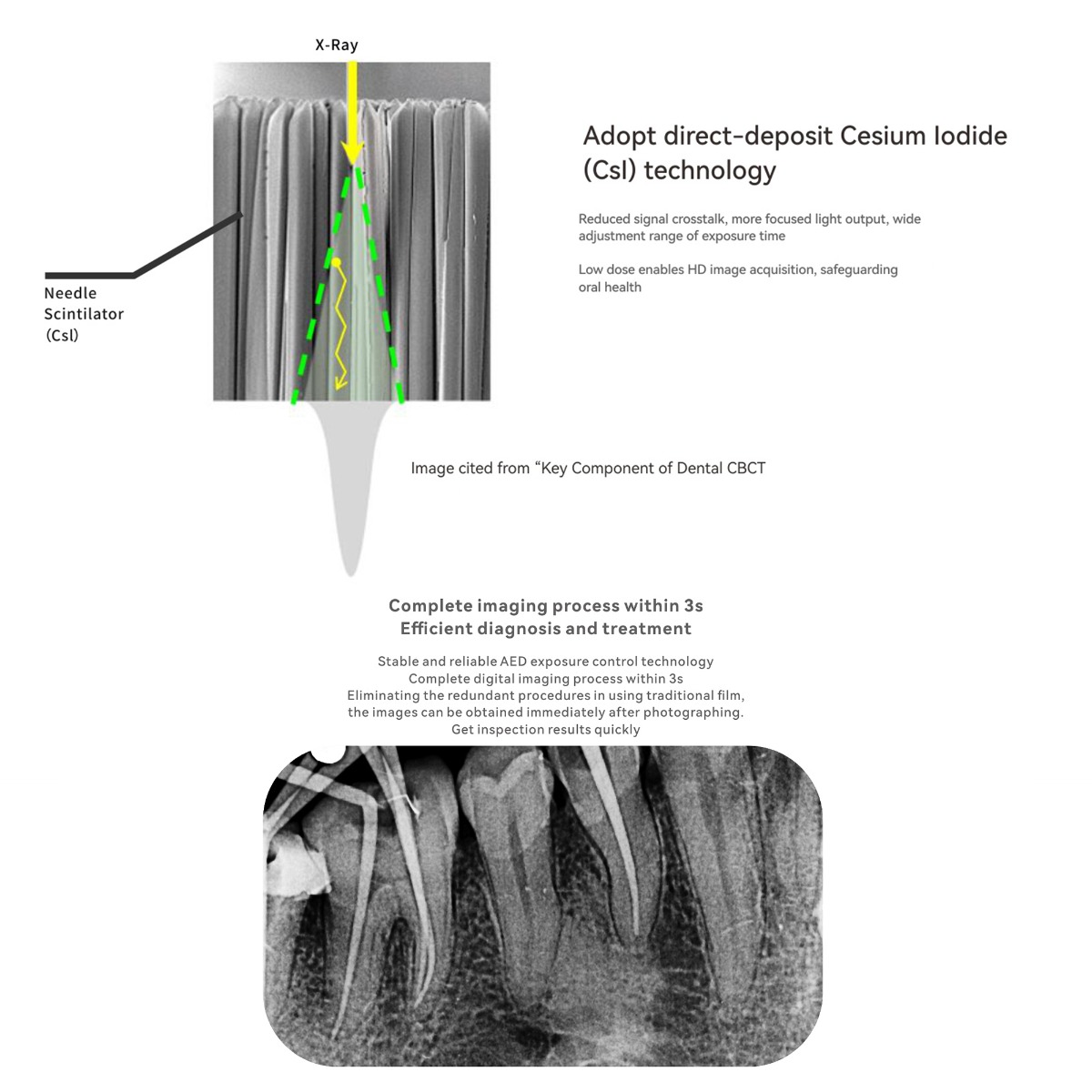 Woodpecker RTA i-Sensor RVG By Waldent