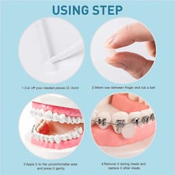 Waldent Ortho Orthodontic Wax - 6
