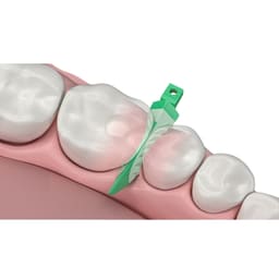 Garrison Dental Strata-G Wedges - 5