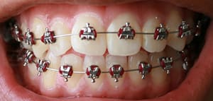 Ortho Organizers Stainless Steel Archwires Natural / Pro Form - Rectangular (25/Pk)