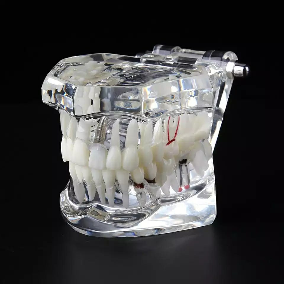 iDENTical All In One Implant Models M2001