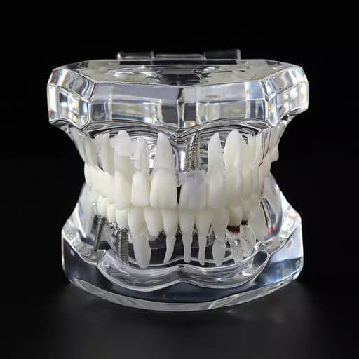 iDENTical All In One Dental Implant Model - M2001 (White)